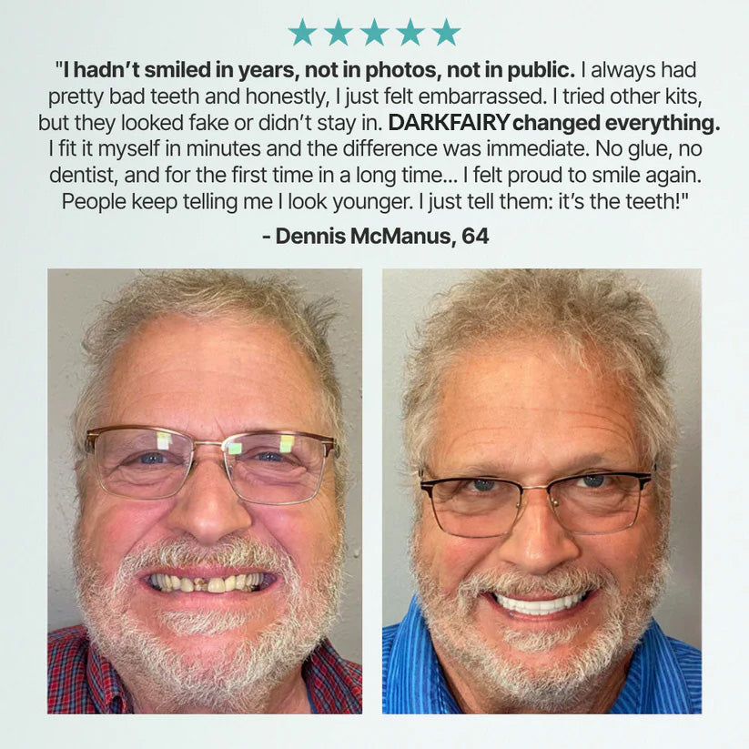 🌎🏆Ends Today: 70% OFF! 🏆2026 Bestselling Product🦷 Fit for a Fresh Smile, Say Goodbye to Wearing Discomfort!