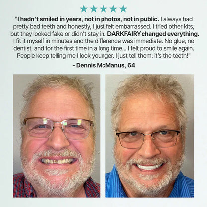 🌎🏆Ends Today: 70% OFF! 🏆2026 Bestselling Product🦷 Fit for a Fresh Smile, Say Goodbye to Wearing Discomfort!